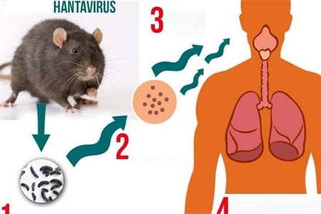 Bệnh do vi rút Hanta và các biện pháp phòng bệnh