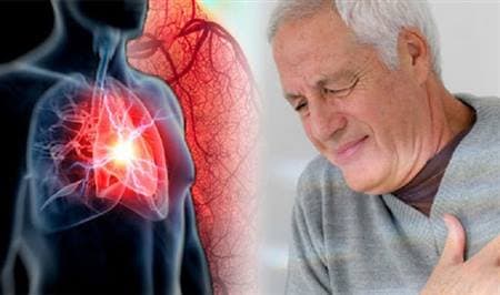 Các bệnh thường gặp ở người cao tuổi vào mùa đông: Phòng bệnh hơn chữa bệnh