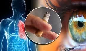 Hút thuốc lá ảnh hưởng thị lực, tăng nguy cơ đục thủy tinh thể